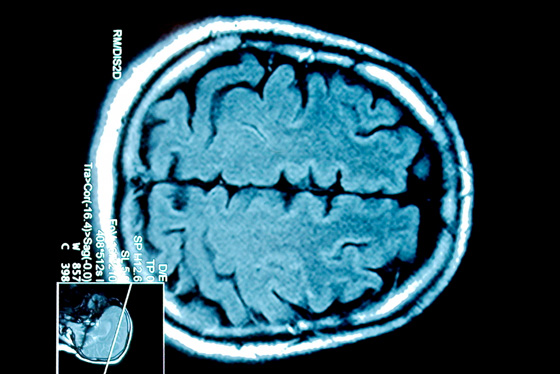 brain-scan
