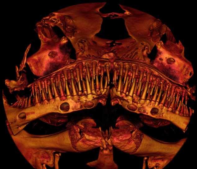 В