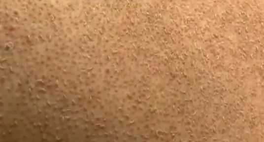 У