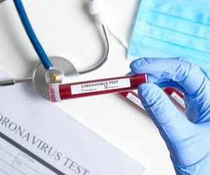 Azerbaijan confirms 1,151 new cases, 9 deaths