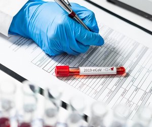 Обнародовано число больных Covid-19 в Азербайджане Обнародовано число больных Covid-19 в Азербайджане