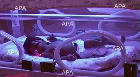Astarada ana ölümünün ilkin səbəbi açıqlanıb - FOTO