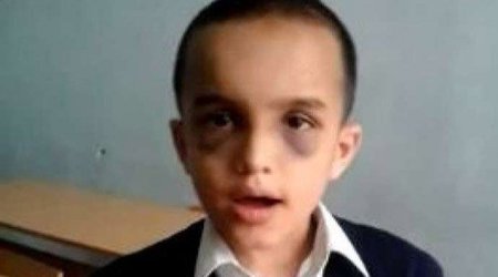 7 yaşlı Nihad: “Afaq müəllimə başıma taxta ilə vurdu” - VİDEO