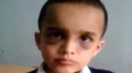 Criminal case launched on beating of 8-year-old child