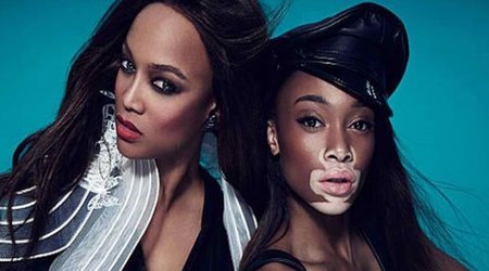How common is skin pigment condition vitiligo?