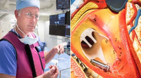 'World's smallest' pacemaker fitted for first time