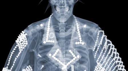 X-ray 'voyeur's' artwork provides a surprising glimpse... - PHOTO
