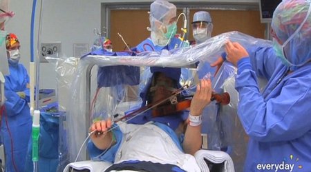 Violinist plays his instrument during BRAIN SURGERY - VIDEO