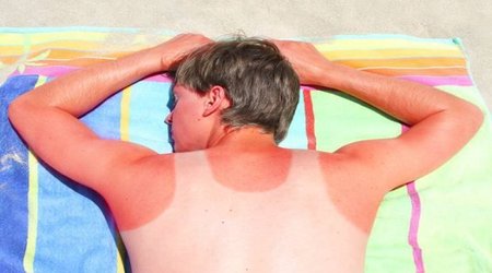 Why the sun is the skin’s frenemy?