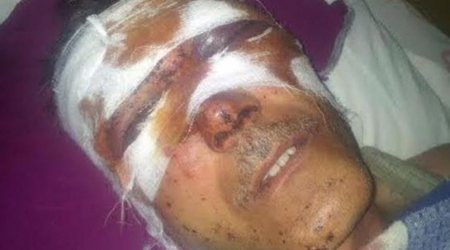Beaten journalist of radio Liberty Ilgar Nasibov - PHOTOS