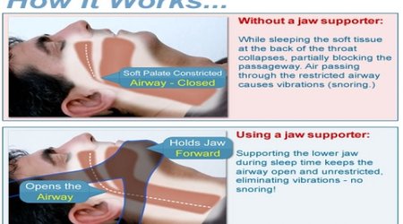 How to stop snoring and sleep well again
