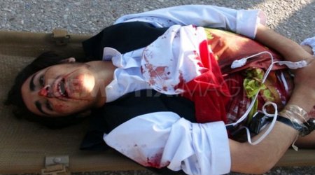 A death by suicide every 40 seconds, says WHO