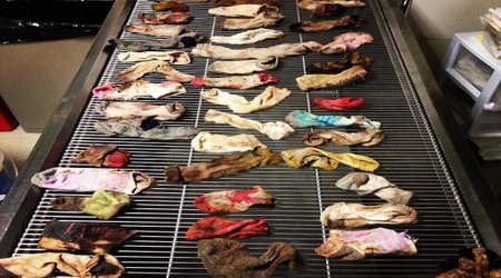 Vets operate on sick dog and find 43 SOCKS in its stomach