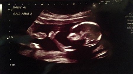 Is this the coolest baby ever?