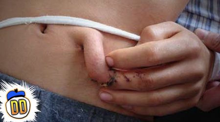 5 People with Extra Bodyparts - PHOTO+VIDEO