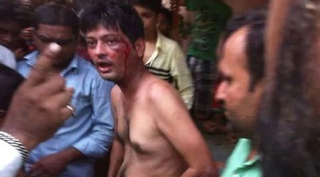Angry mob hacks off alleged rapist's genitals