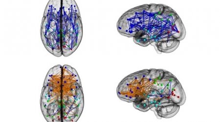 Men and women's brains are 'wired differently'