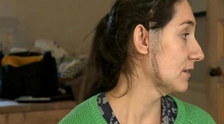 Heavily pregnant woman slashed across the face in ‘random’ attack
