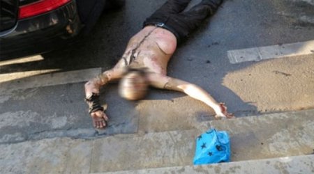 Health minister visits Azeri man who set himself alight