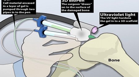 'Bio-pen' could allow doctors to draw-on human cells