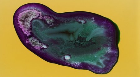 Astonishing photographs of drugs - PHOTO