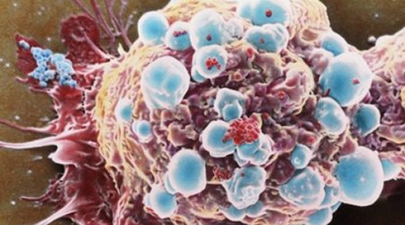 "Sticky balls" stop cancer spreading
