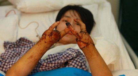 See what doctors managed to do - PHOTO