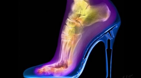 X-ray photography that shows the world in a whole new light