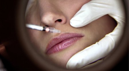 Is cosmetic surgery now a normal part of modern life?