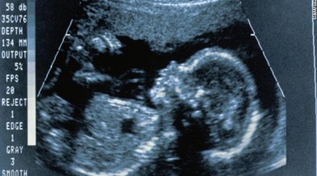 'Putting the next generation of brains in danger'