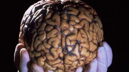 How building a library of brains could save lives