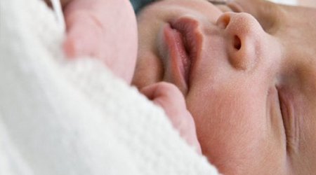 C-section birth "link to later obesity"