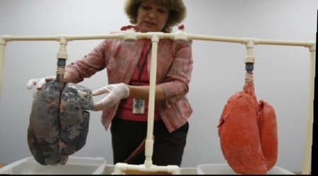 Smokers vs Normal Lungs - VIDEO