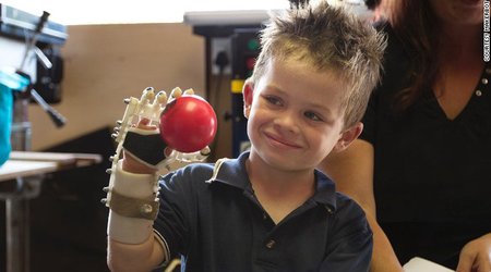 3-D printing the human body - PHOTO