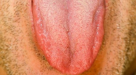 What does your tongue say about your health?