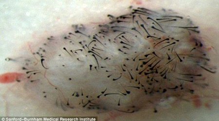 A cure for hair loss?