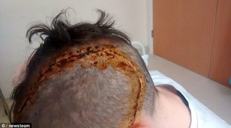 Horrific injuries of 16-year-old boy