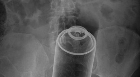 Most unusual X-rays