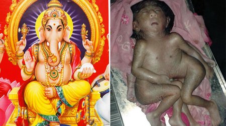 Baby born with EIGHT limbs worshipped as 'Hindu God'