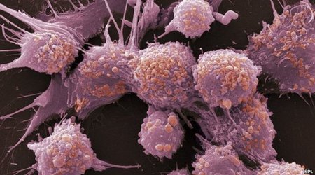 Prostate cancer drug 'extends lives'