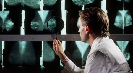 Drug could help slow half of breast cancers