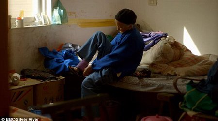 The agony of living with bound feet