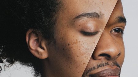 Why do women live lonnger than men?
