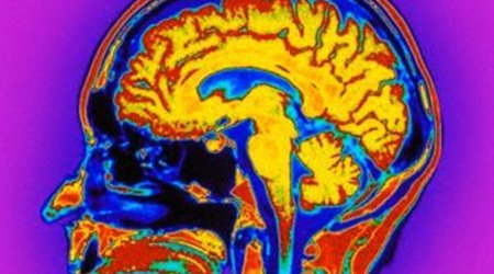 Do YOU have autistic traits?