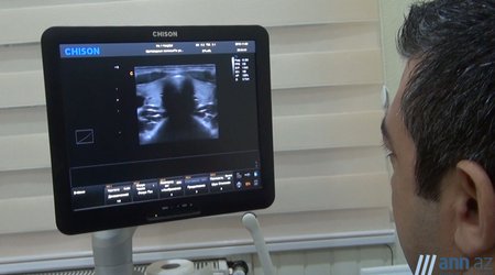 Həkim məsləhəti: "Zob"un müalicəsi - ANN.TV 17 noyabr