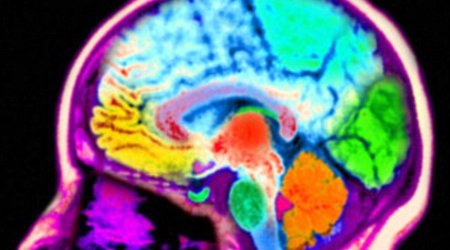 Brains of men and women are NOT different overall