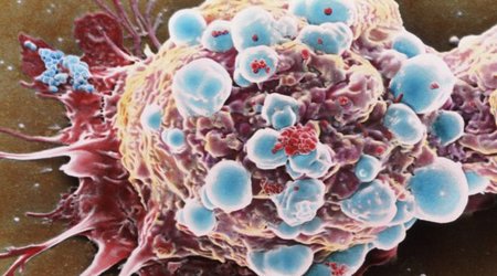 Cancer is not just 'bad luck' but down to environment