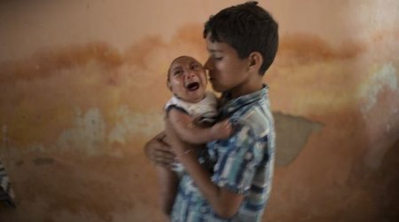 Zika virus: Study supports link to microcephaly