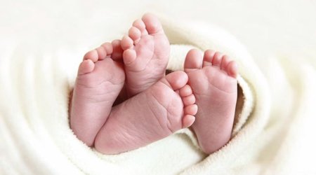 Vietnam twins found to have different fathers in rare case