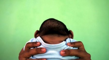 Spain registers first Zika microcephaly birth in Europe